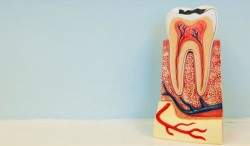 Tackling Tough Anatomy with Modern Endodontic Technology